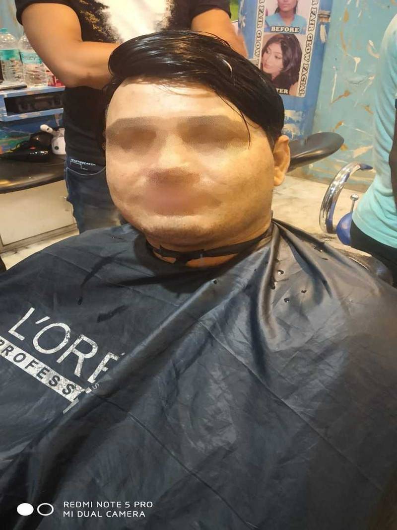 human-hair-fixing-men-03
