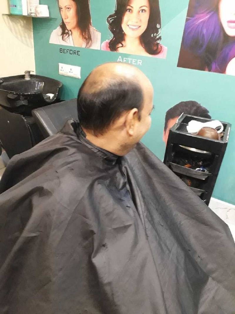 human-hair-fixing-men-04